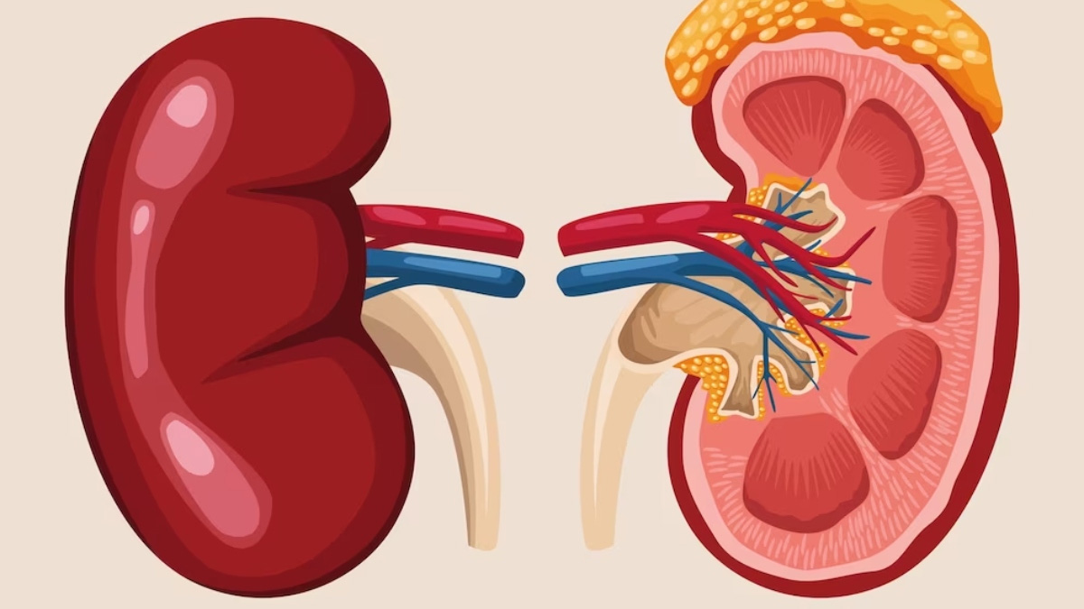 kidney-tumor-and-cancer