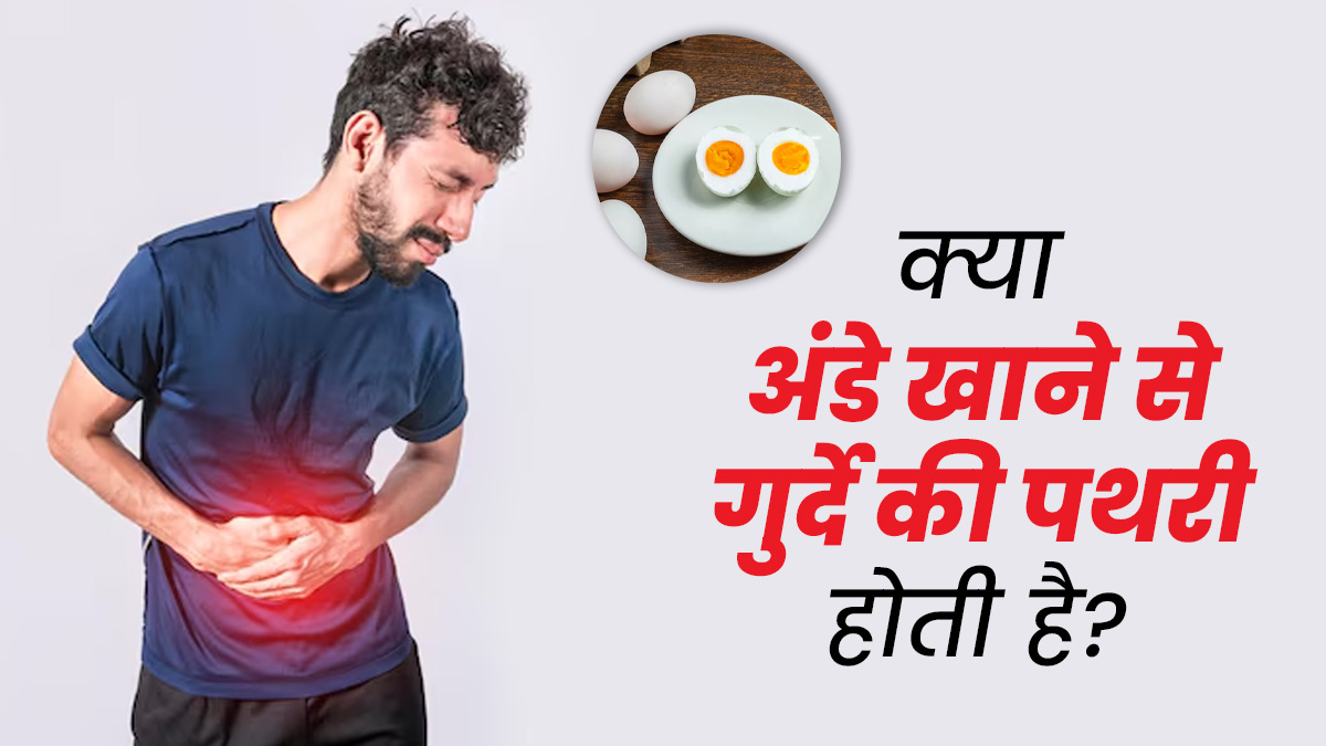 क्या वाकई अंडे खाने से किडनी की पथरी हो सकती है? जानें डॉक्टर से