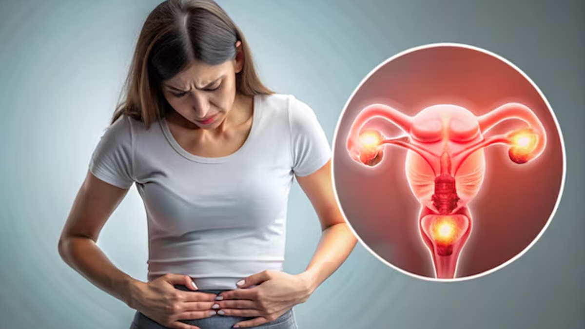 इन 4 बीमारियों में नजर आते हैं PCOS जैसे लक्षण, न करें अनदेखी