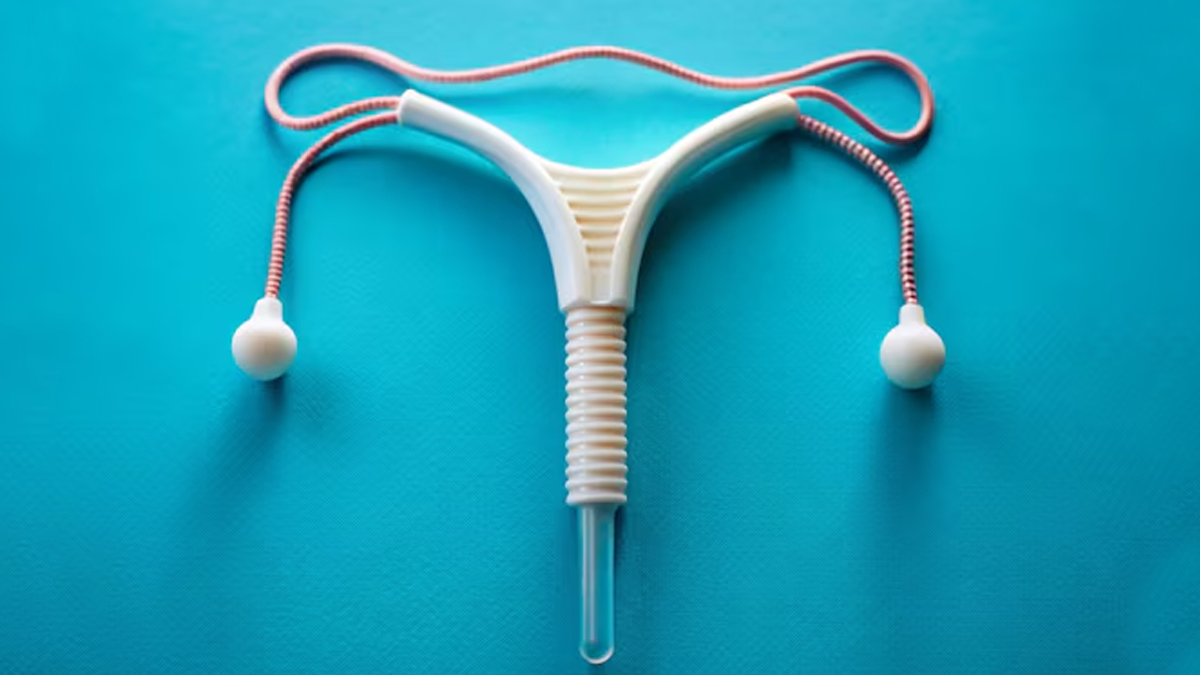types of IUDs and which one is right best 01 (1)