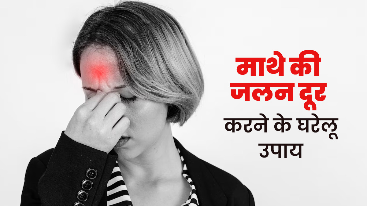 माथे पर हो रही है जलन? जानें इसका कारण और राहत के ल‍िए अपनाएं ये 5 घरेलू उपाय