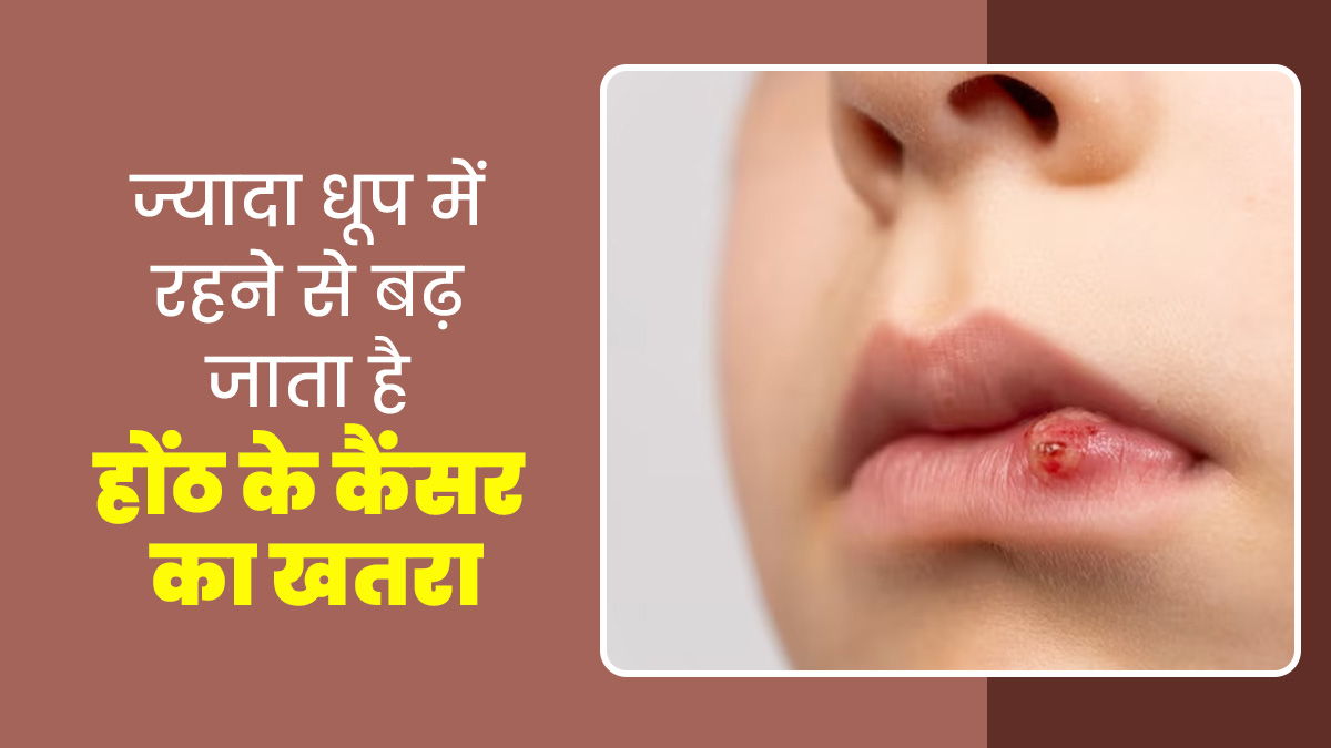 ज्यादा धूप में रहने से बढ़ जाता है होंठ के कैंसर का खतरा, जानें इसके लक्षण