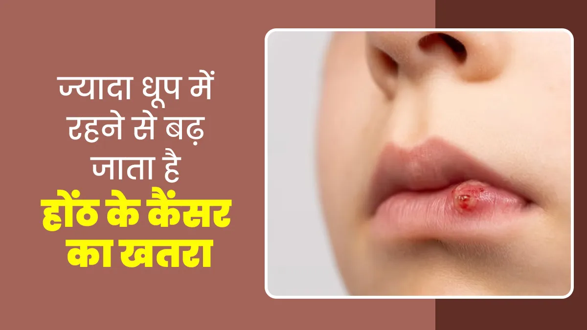 ज्यादा धूप में रहने से बढ़ जाता है होंठ के कैंसर का खतरा, जानें इसके लक्षण