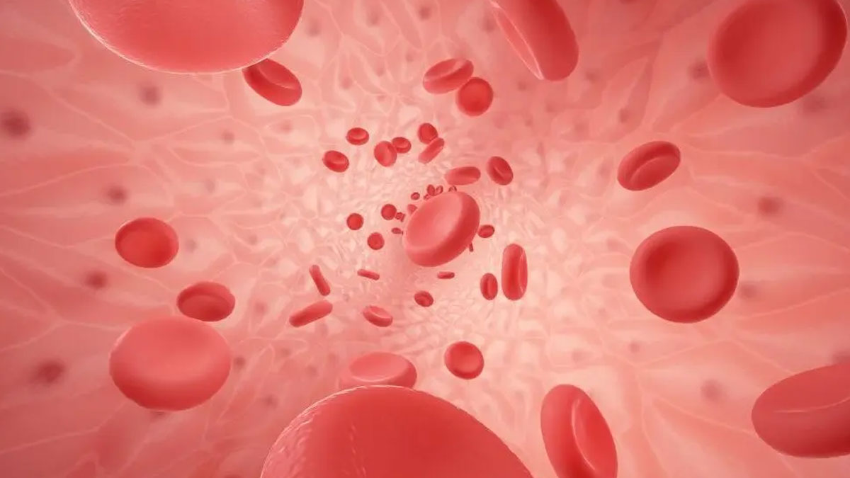 Thrombocytosis