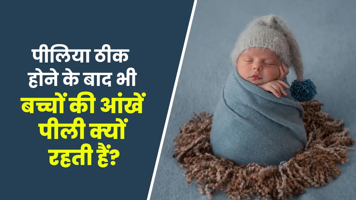 नवजात शिशु का पीलिया ठीक होने के बाद भी आंखें क्यों रहती है पीली, डॉक्टर से जानें
