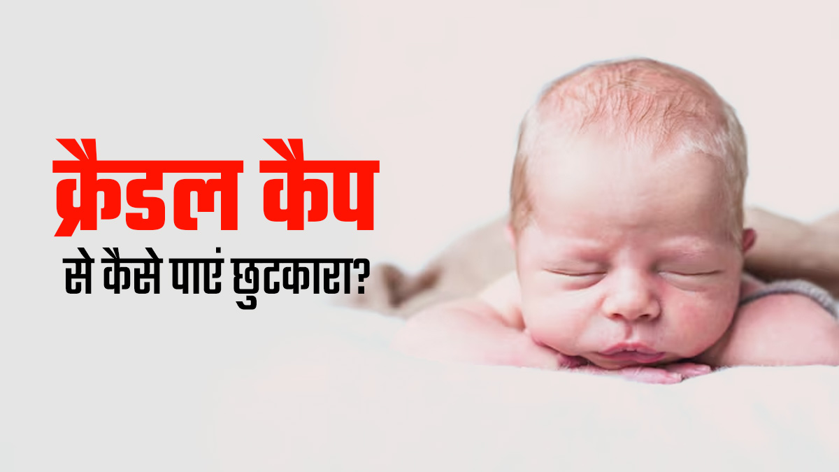 बच्चे के सिर में जमी पीली पपड़ी (क्रैडल कैप) का इलाज कैसे करें? जानें डॉक्टर से
