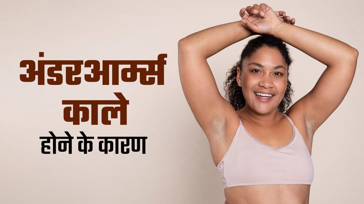 अंडरआर्म्स काले होने के क्या कारण हो सकते हैं? डॉक्टर से जानें