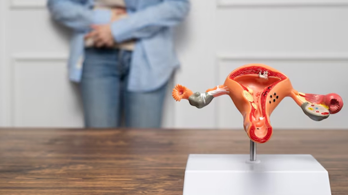 can fibroids come back after hysterectomy 01 (2)