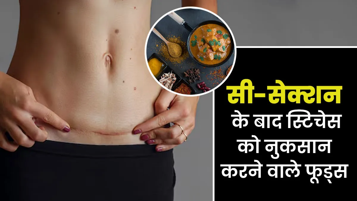 सिजेरियन डिलीवरी के बाद इन 4 फूड्स से बनाएं दूरी, टांकों को पहुंचाएंगे नुकसान