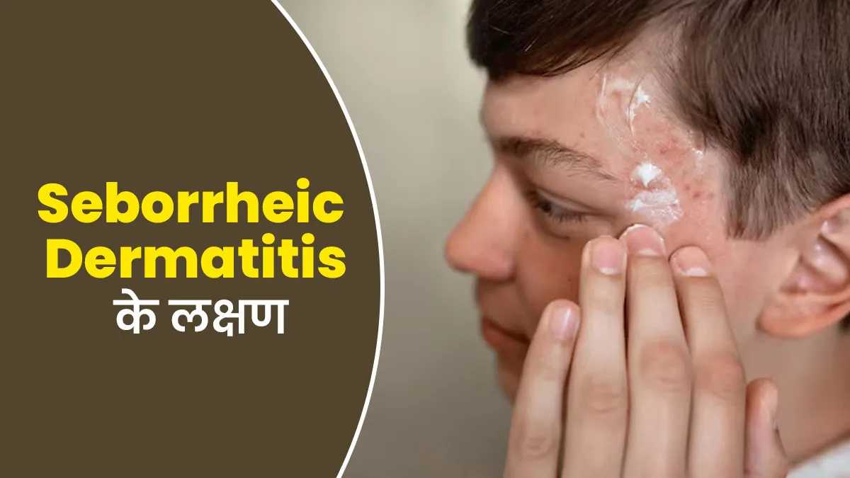 सेबोरिक डर्मेटाइटिस होने पर नजर आते हैं ये 4 लक्षण, एक्सपर्ट से जानें बचाव