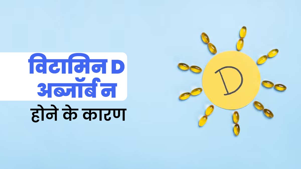 धूप में रहने के बाद भी शरीर में बनी रहती है विटामिन D की कमी? डॉक्टर से जानें क्या हो सकते हैं कारण