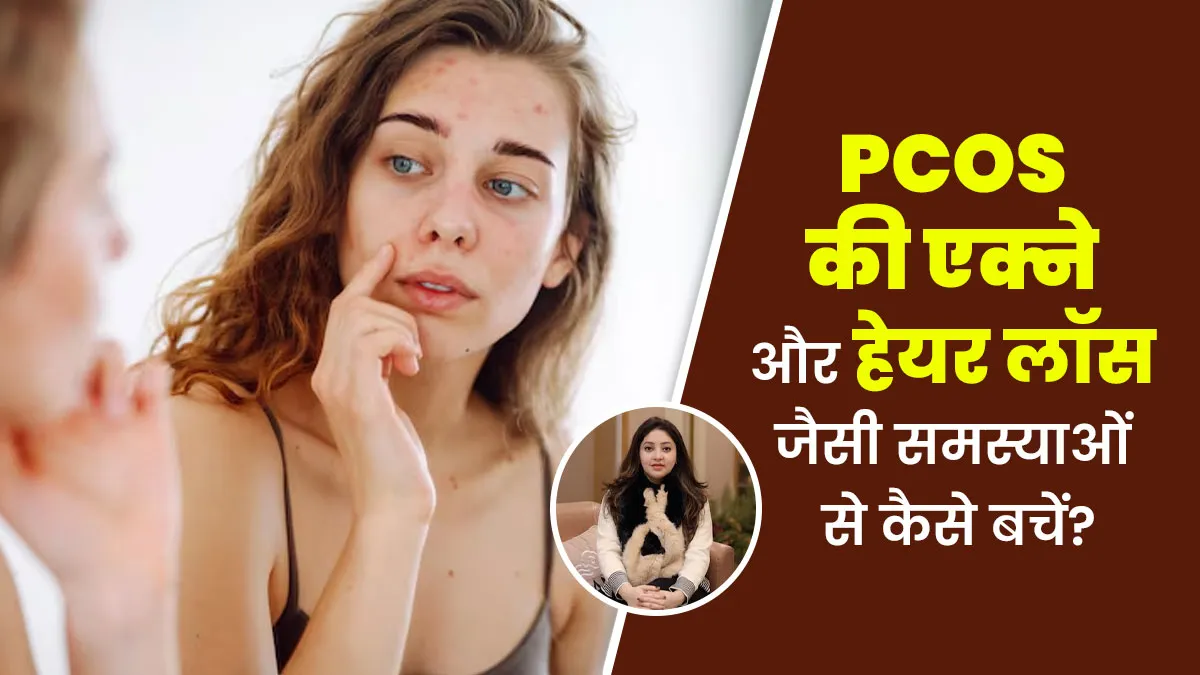 PCOS में चेहरे पर अनचाहे बाल, मुंहासे और बालों के झड़ने जैसी समस्याओं को नेचुरली कैसे ठीक करें?