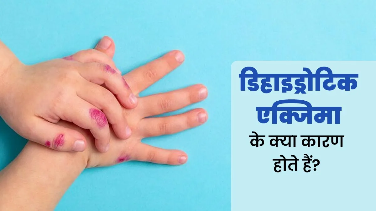 त्वचा पर छाले होना हो सकता है डिहाइड्रोटिक एक्जिमा का लक्षण, डॉक्टर से जानें इसके कारण