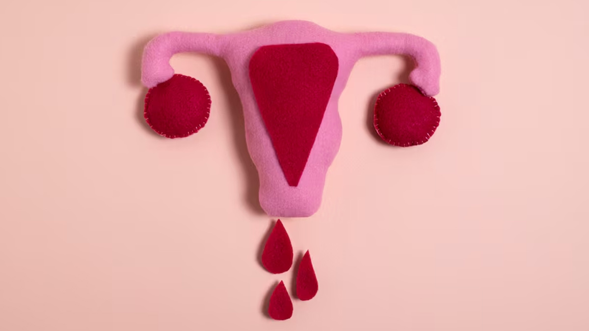 endometriosis-inside3