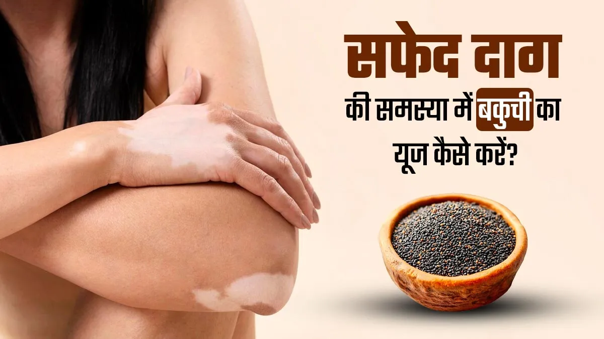 सफेद दाग की समस्या में बावची या बाकुची का उपयोग कैसे करें? जानें डॉक्टर से