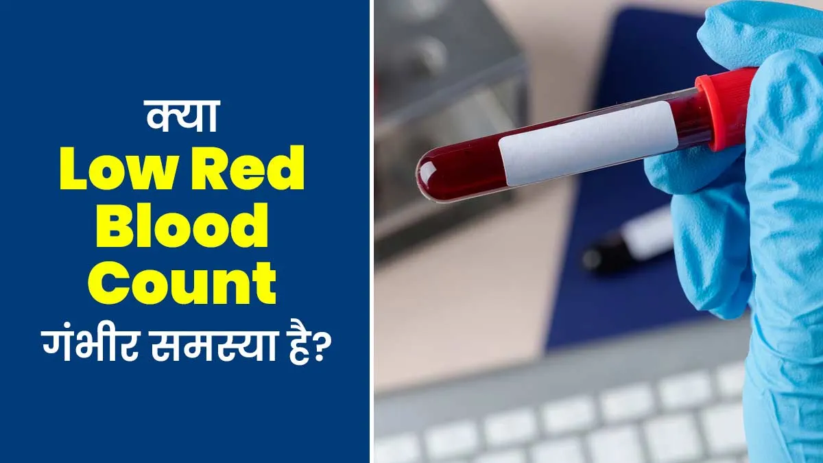क्या रेड ब्लड सेल्स (RBC) कम होना गंभीर समस्या है? जानें डॉक्टर की राय