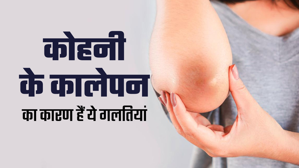 कोहनी के कालेपन की वजह हो सकती हैं स्किनकेयर से जुड़ी ये 5 गलत‍ियां, तुरंत करें सुधार
