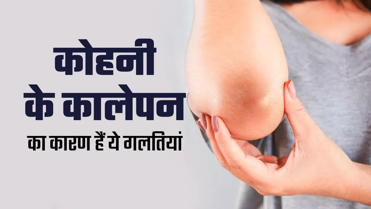 कोहनी के कालेपन की वजह हो सकती हैं स्किनकेयर से जुड़ी ये 5 गलत‍ियां, तुरंत करें सुधार
