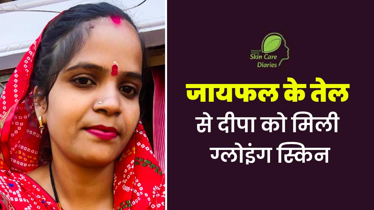 स्किन केयर डायरी : डिलीवरी के बाद दीपा के चेहरे पर हो गई थी झाइयां और झुर्रियां, जायफल के तेल से पाया छुटकारा