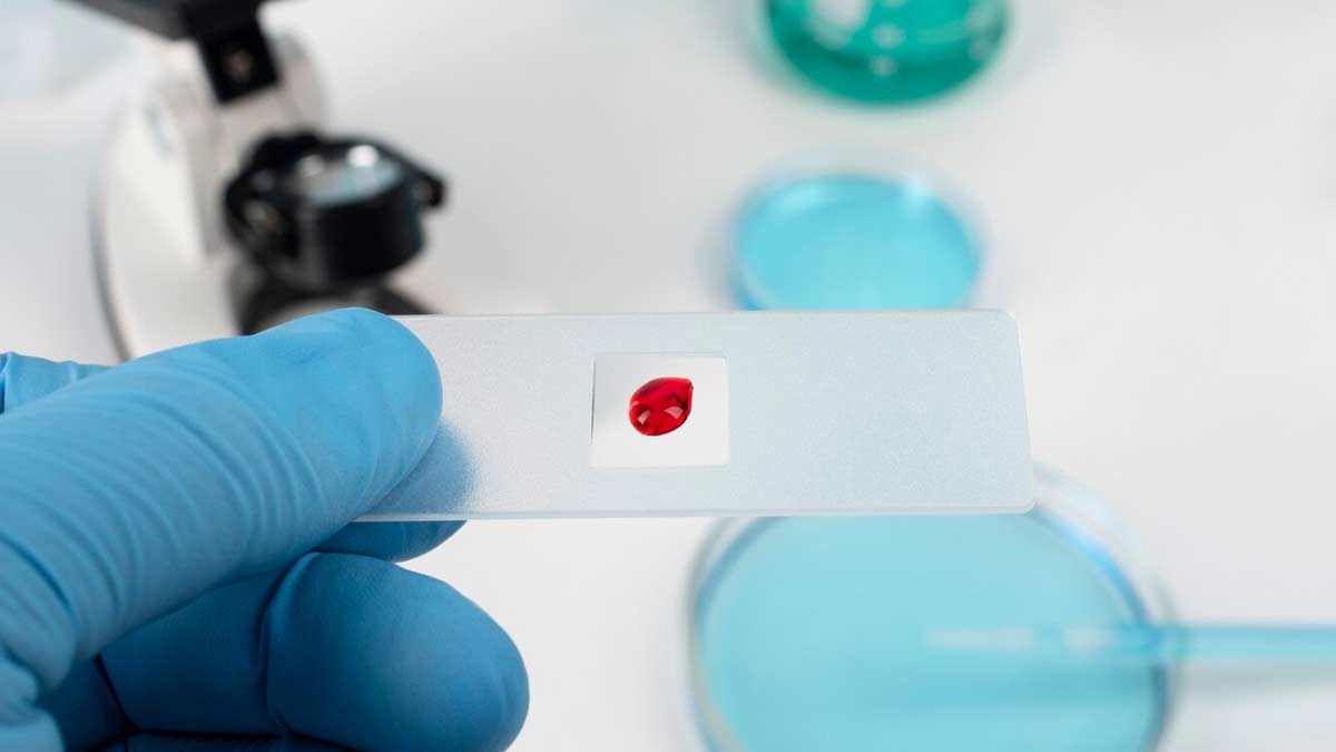 Is Low Red Blood Count Serious