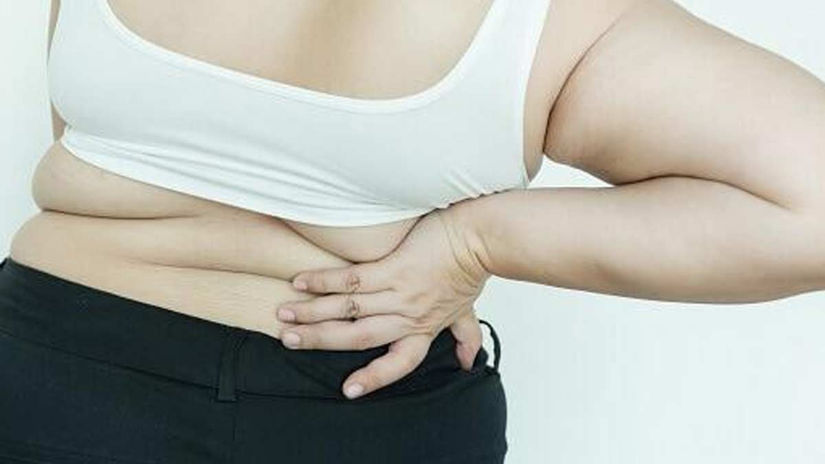 back-pain-obesity