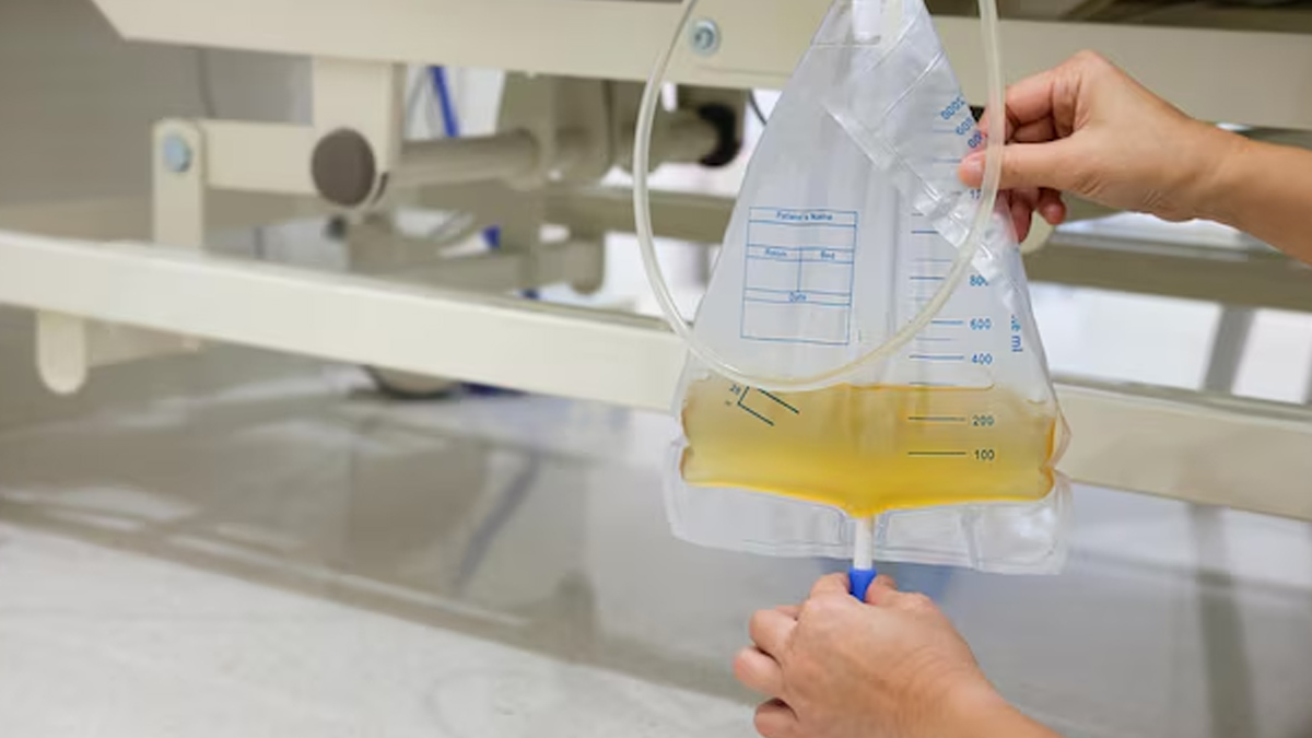 Complications associated with urine pipes 1 (1)