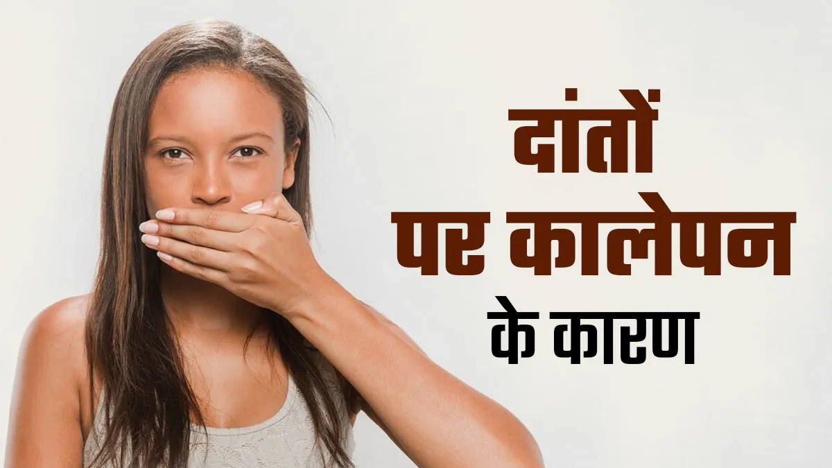 दांतों पर दिख रहे काले धब्बों के कारण आप भी हो जाते हैं शर्मिंदा, डॉक्टर से जानें इसका कारण