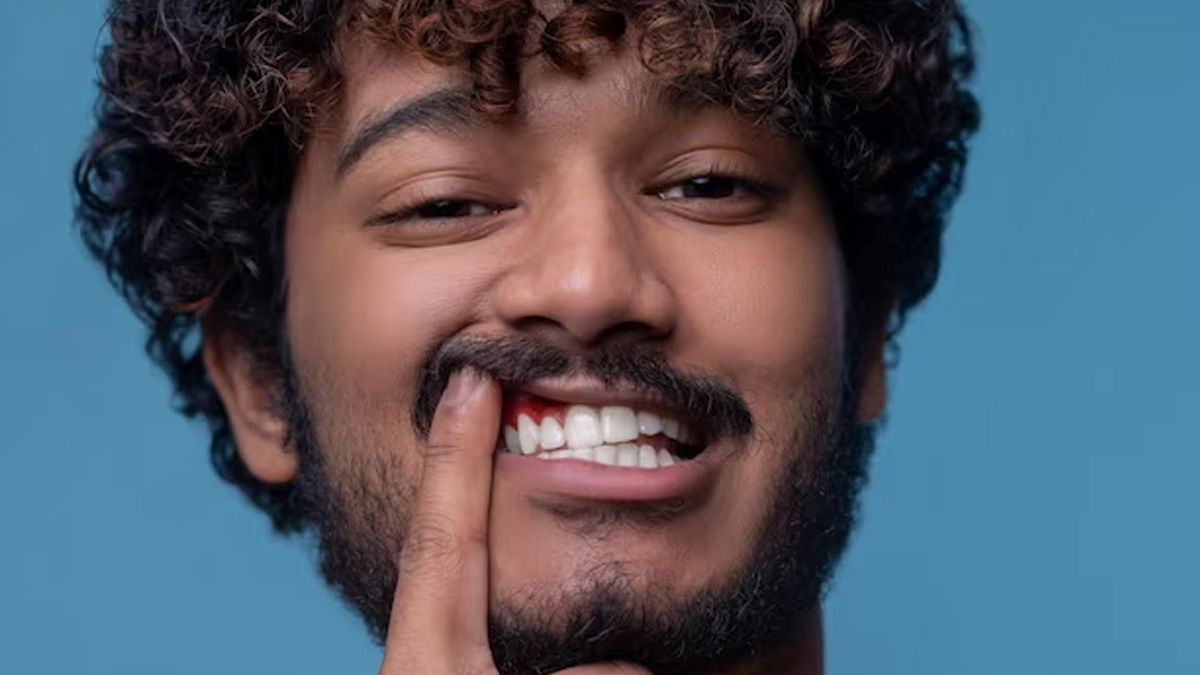 black spots on teeth