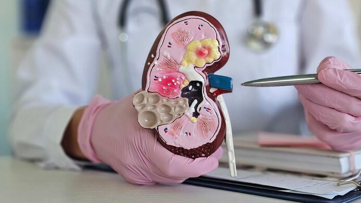 Treatment For Kidney Shrinkage