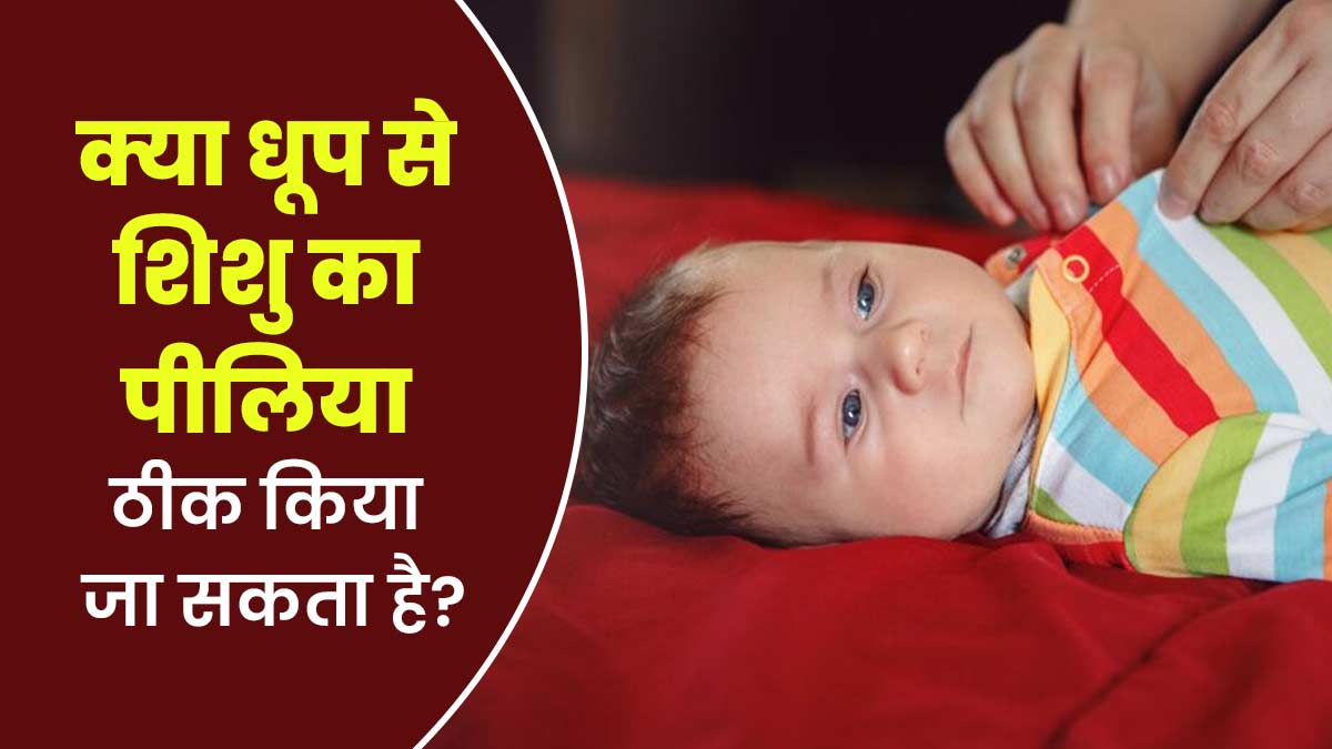 क्या धूप से शिशु का पीलिया ठीक किया जा सकता है? डॉक्टर से जानें