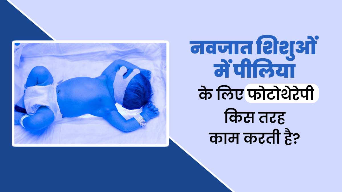 नवजात शिशुओं में पीलिया के लिए फोटोथेरेपी किस तरह काम करती है? समझें डॉक्टर से