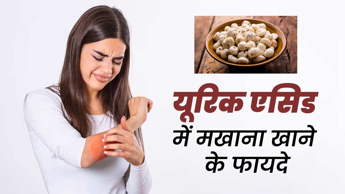 क्या हाई यूरिक एसिड में मखाना खाना फायदेमंद होता है? एक्सपर्ट से जानें
