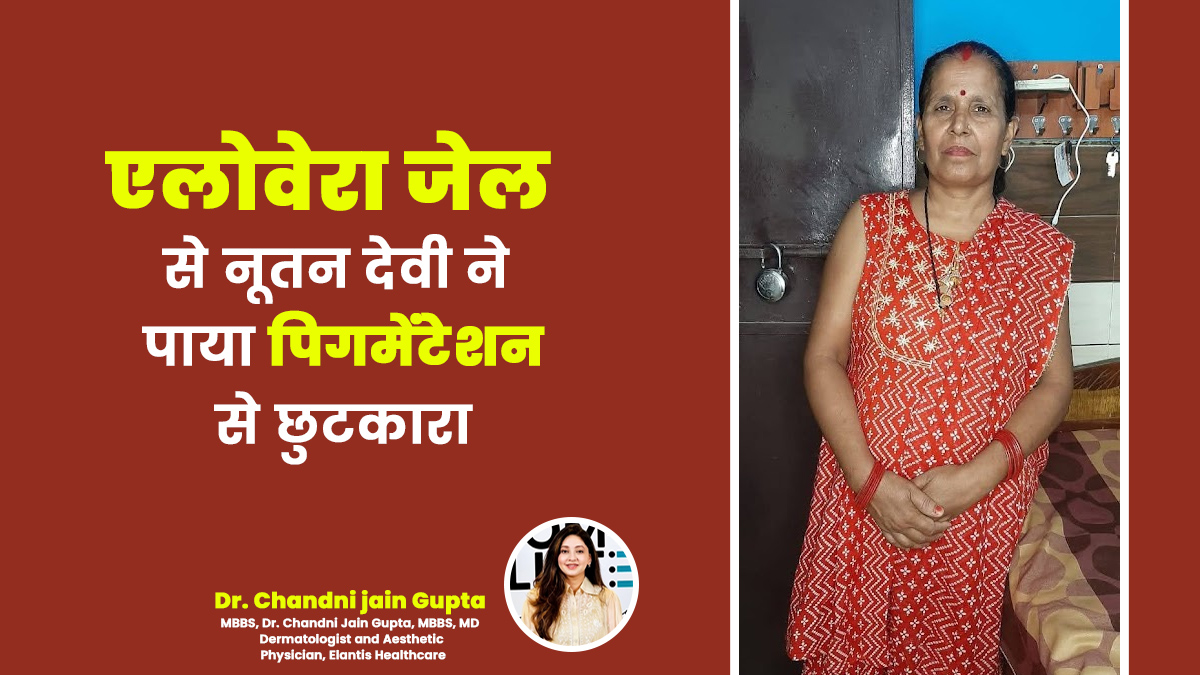थायराइड और बढ़ती उम्र के कारण पिगमेंटेशन से परेशान थीं नूतन देवी, एलोवेरा की मदद से मिली जवां त्वचा