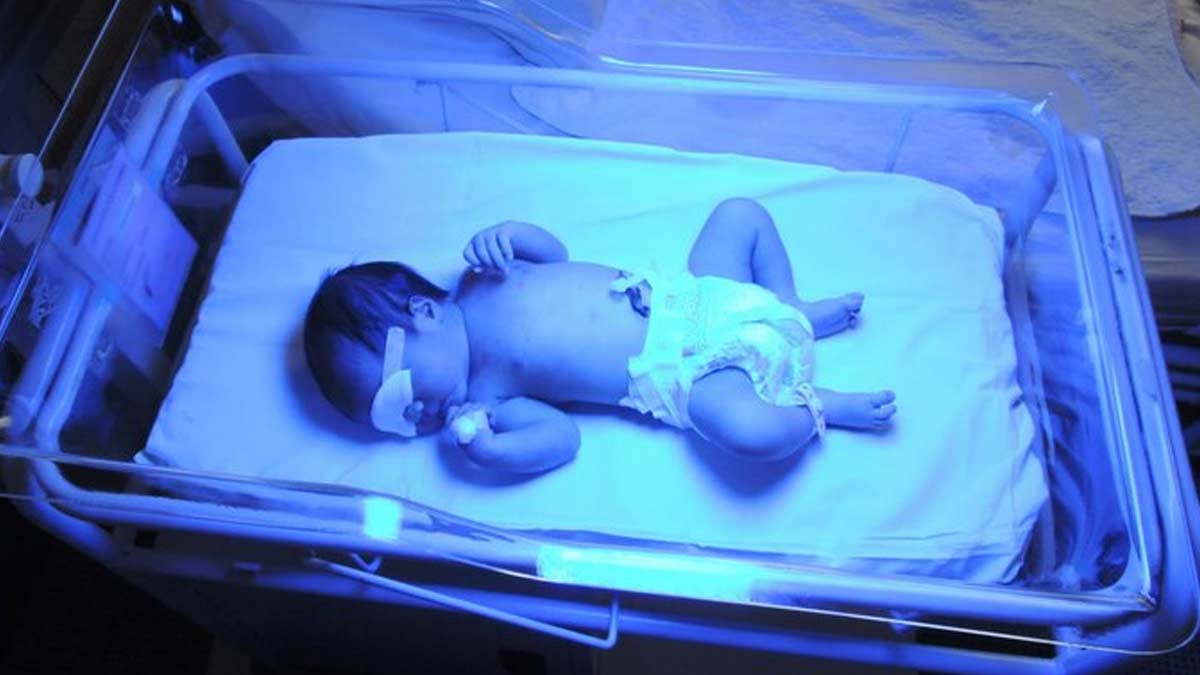 how does phototherapy work for jaundice 01 (2)