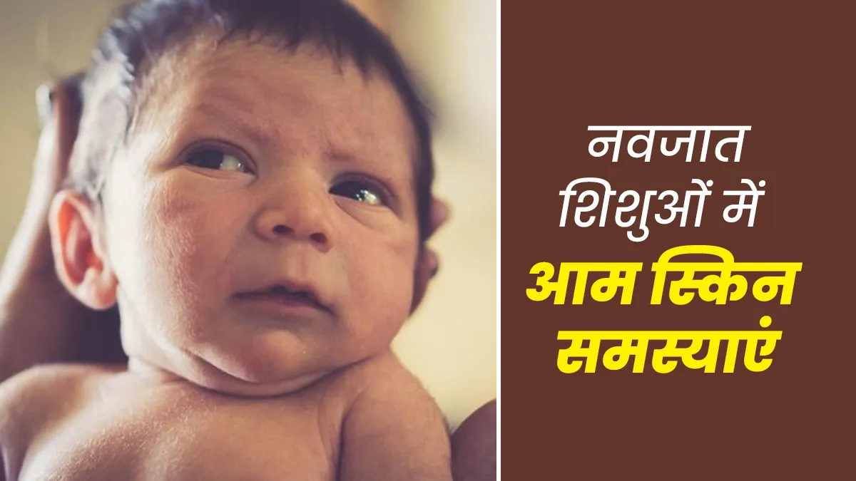 नवजात शिशुओं में आम होती हैं ये 6 स्किन केयर समस्याएं, जानें कैसे करें केयर