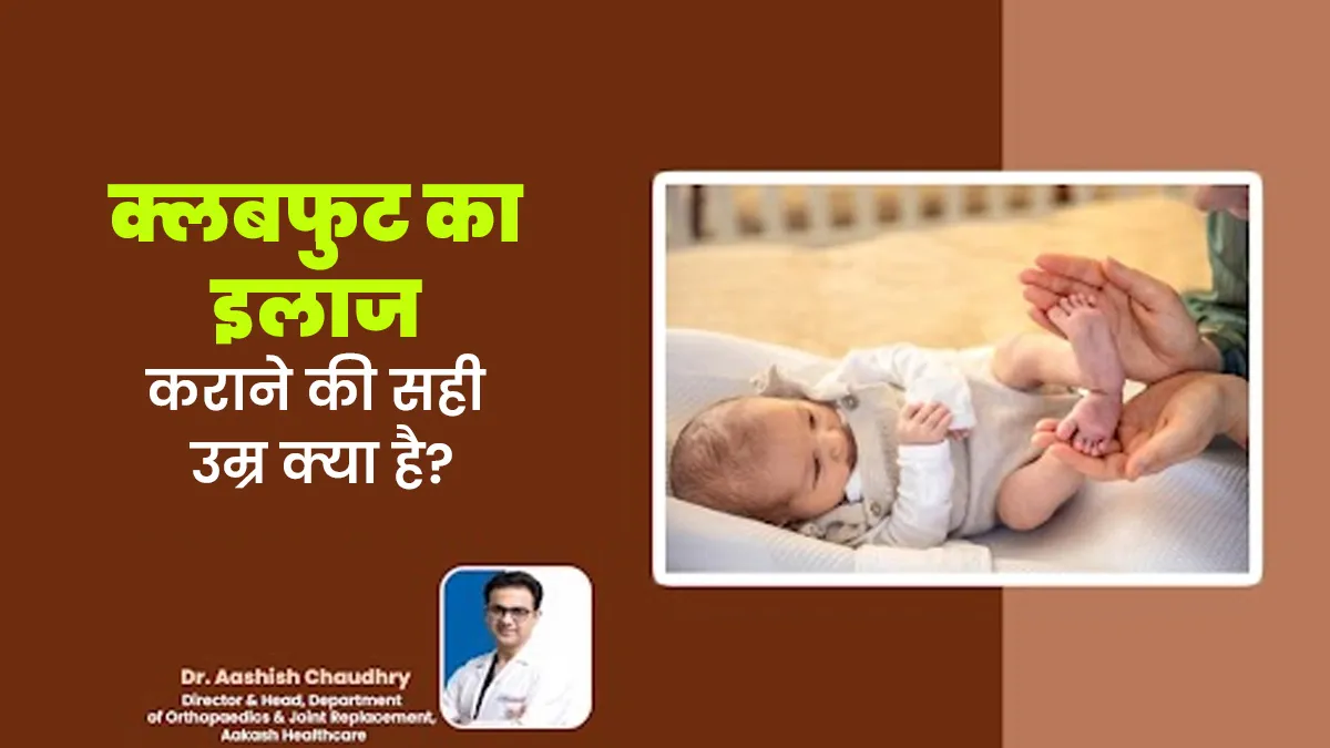 क्लबफुट का इलाज कराने की सही उम्र क्या है? डॉक्टर से जानें