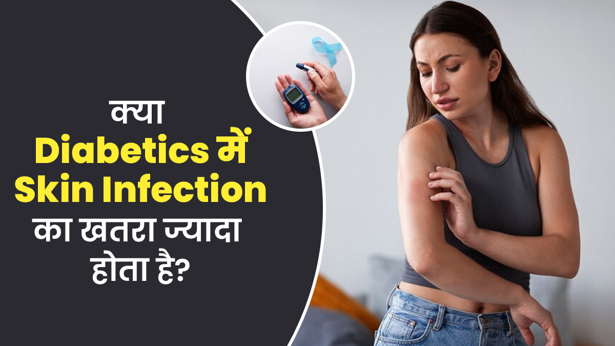 क्या डायबिटीज रोगियों को स्किन इंफेक्शन का खतरा ज्यादा होता है? जानें एक्सपर्ट से