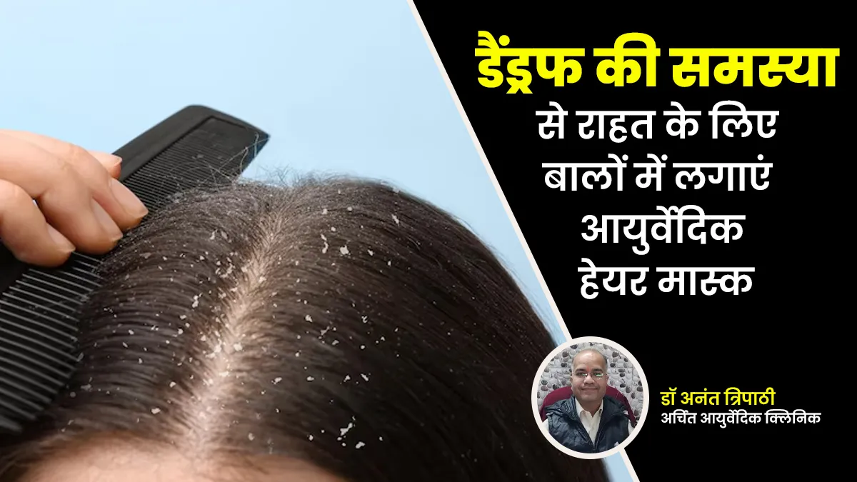 डैंड्रफ की समस्या से राहत के लिए घर पर बनाएं यह आयुर्वेदिक हेयर मास्क, मिलेंगे कई लाभ