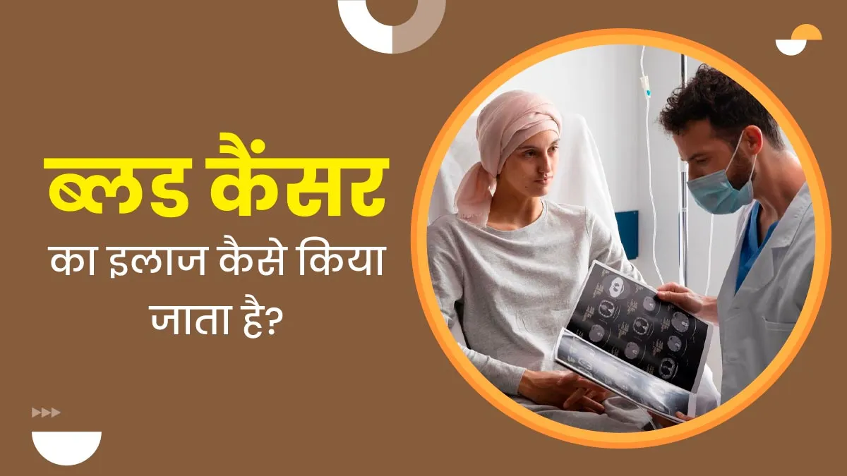 ब्लड कैंसर का इलाज कैसे किया जाता है? डॉक्टर से जानें