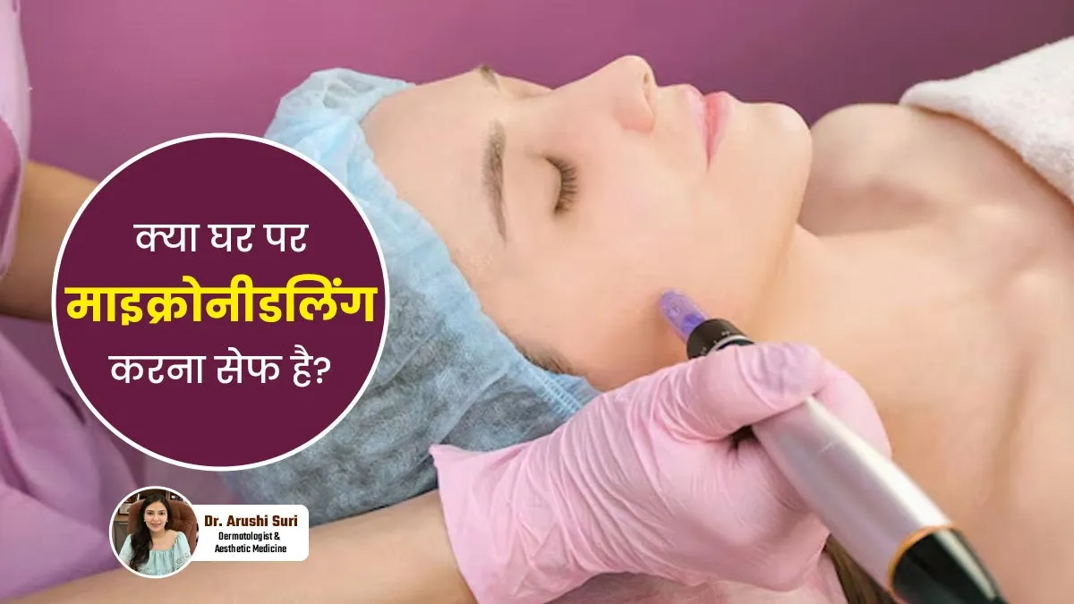 क्या घर पर माइक्रोनीडलिंग करना सुरक्षित है? डॉक्टर से जानें
