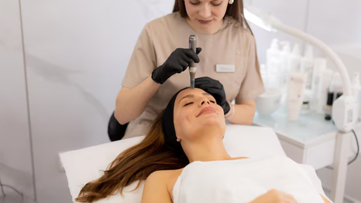 microneedling at home