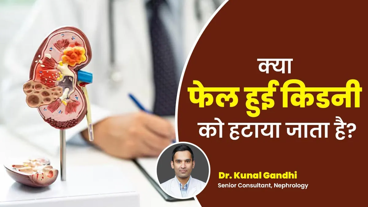 क्या किडनी ट्रांसप्लांट फेल होने के बाद खराब किडनी को हटाया जाता है? डॉक्टर से जानें