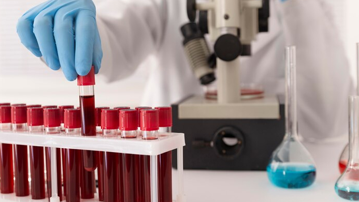 Uremia In Hindi uremia-causes-and-complications-in