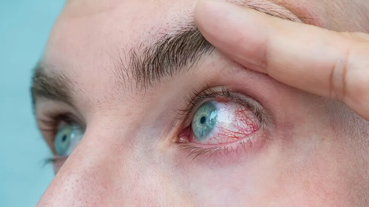 World Glaucoma Day 2025: 40 की उम्र के बाद क्यों बढ़ जाता है आंखों में ग्लूकोमा होने का खतरा? एक्सपर्ट से जानें