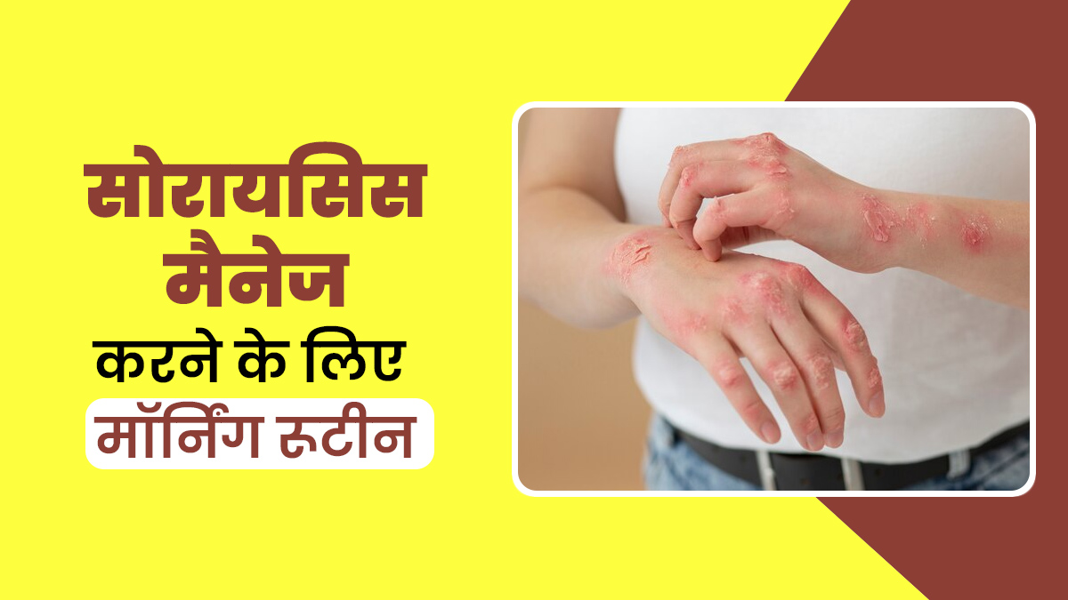 सोरायसिस है तो फॉलो करें ये हेल्दी मॉर्निंग रूटीन, समस्या में मिलेगा आराम