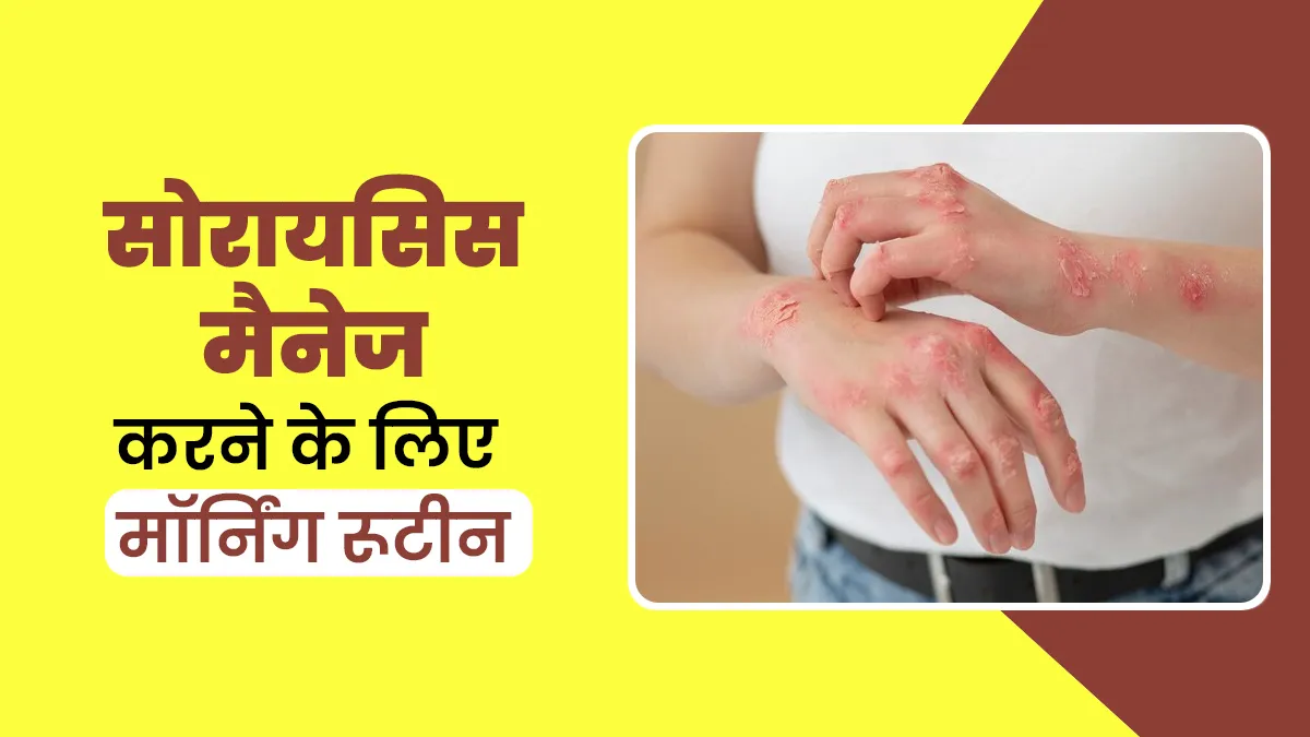 सोरायसिस है तो फॉलो करें ये हेल्दी मॉर्निंग रूटीन, समस्या में मिलेगा आराम