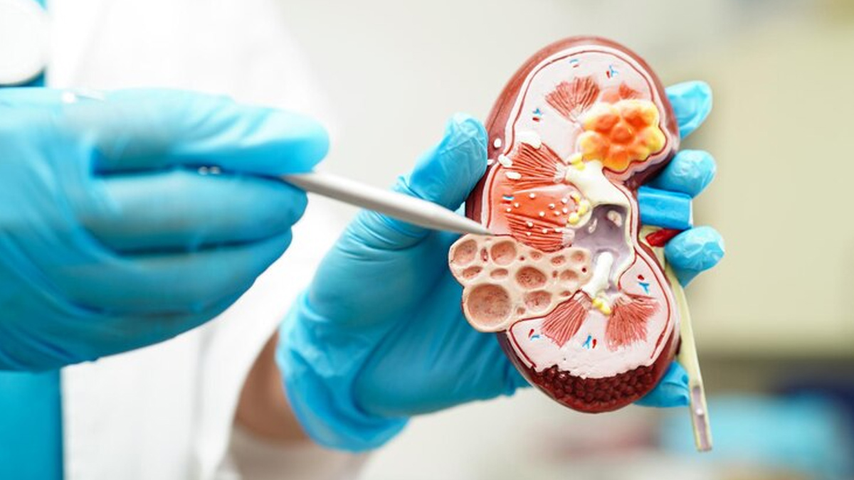 Dialysis Vs Kidney Transplant
