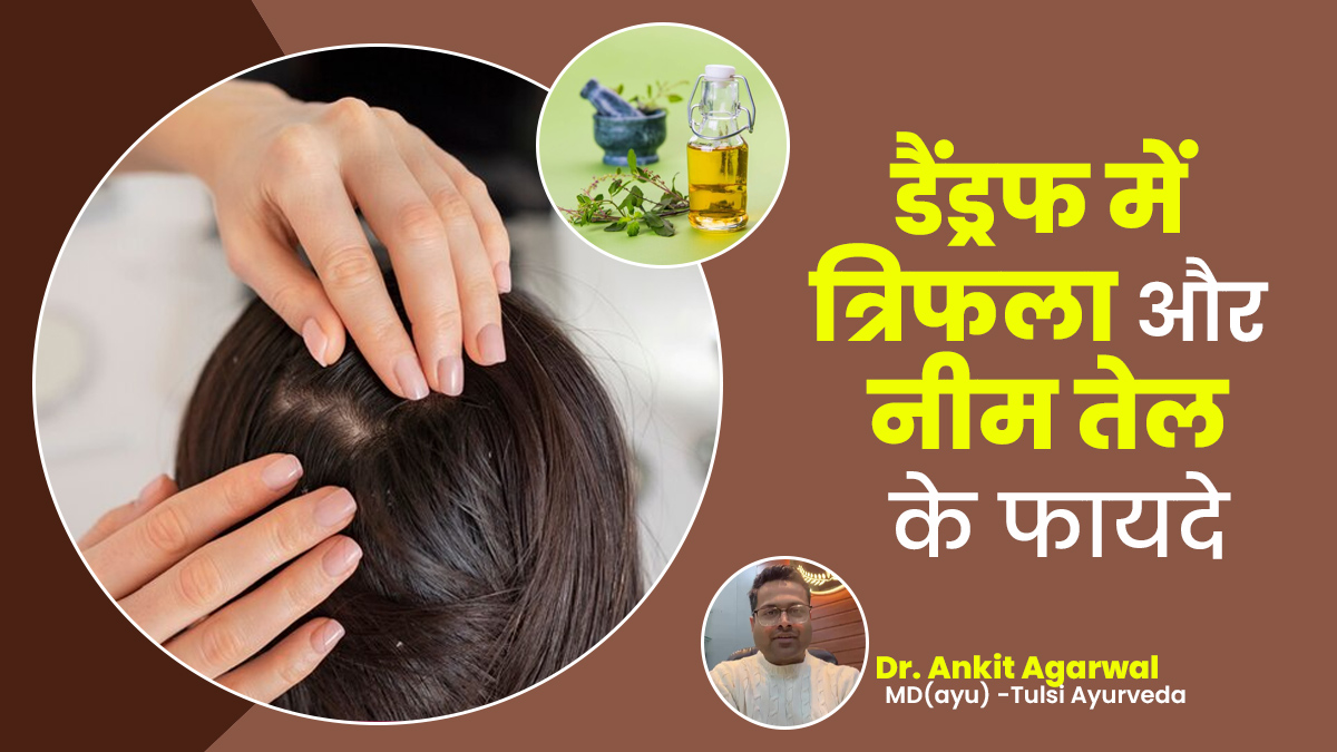डैंड्रफ से राहत पाने के लिए बालों की करें त्रिफला और नीम तेल से मसाज, आयुर्वेदाचार्य से जानें इसके बारे में