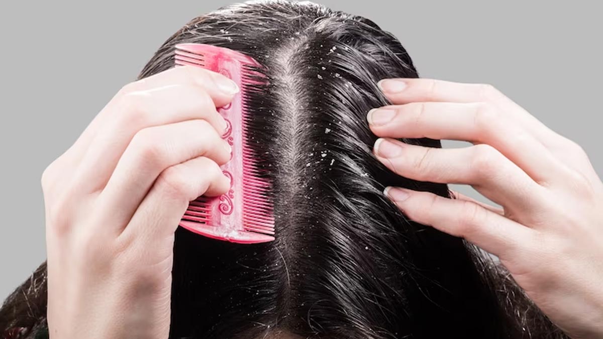 Triphala-and-Neem-oil-Massage-Benefits-for-Dandruff-inside