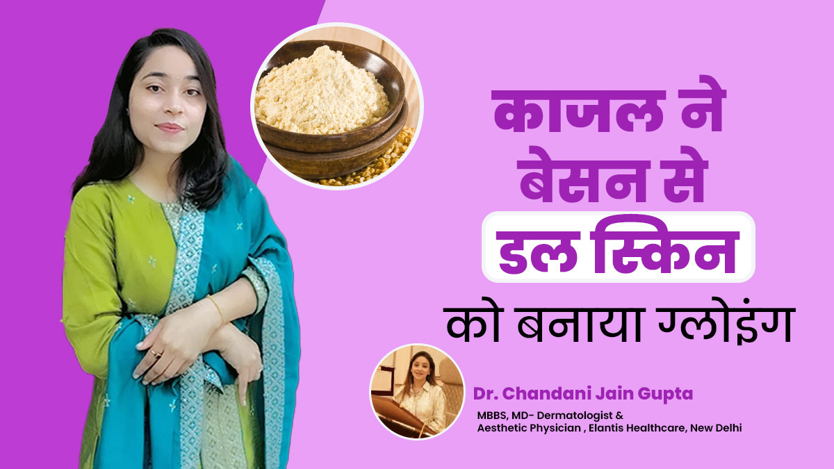 डल स्किन से परेशान थीं काजल सेंगर, रोजाना बेसन से चेहरा धोकर स्किन को बनाया ग्लोइंग